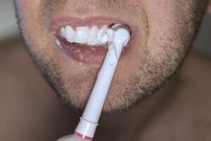 ホワイトニング失敗の体験談から学ぶ成功の秘訣は？