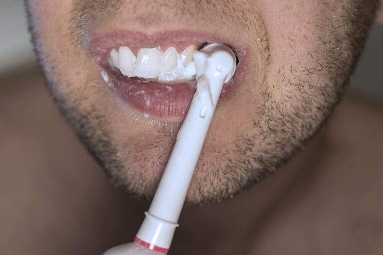 ホワイトニングで失敗しないための口コミは？
